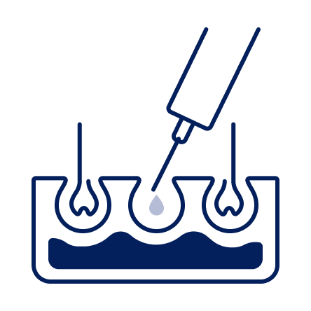 FUE Treatment Journey Icon 2
