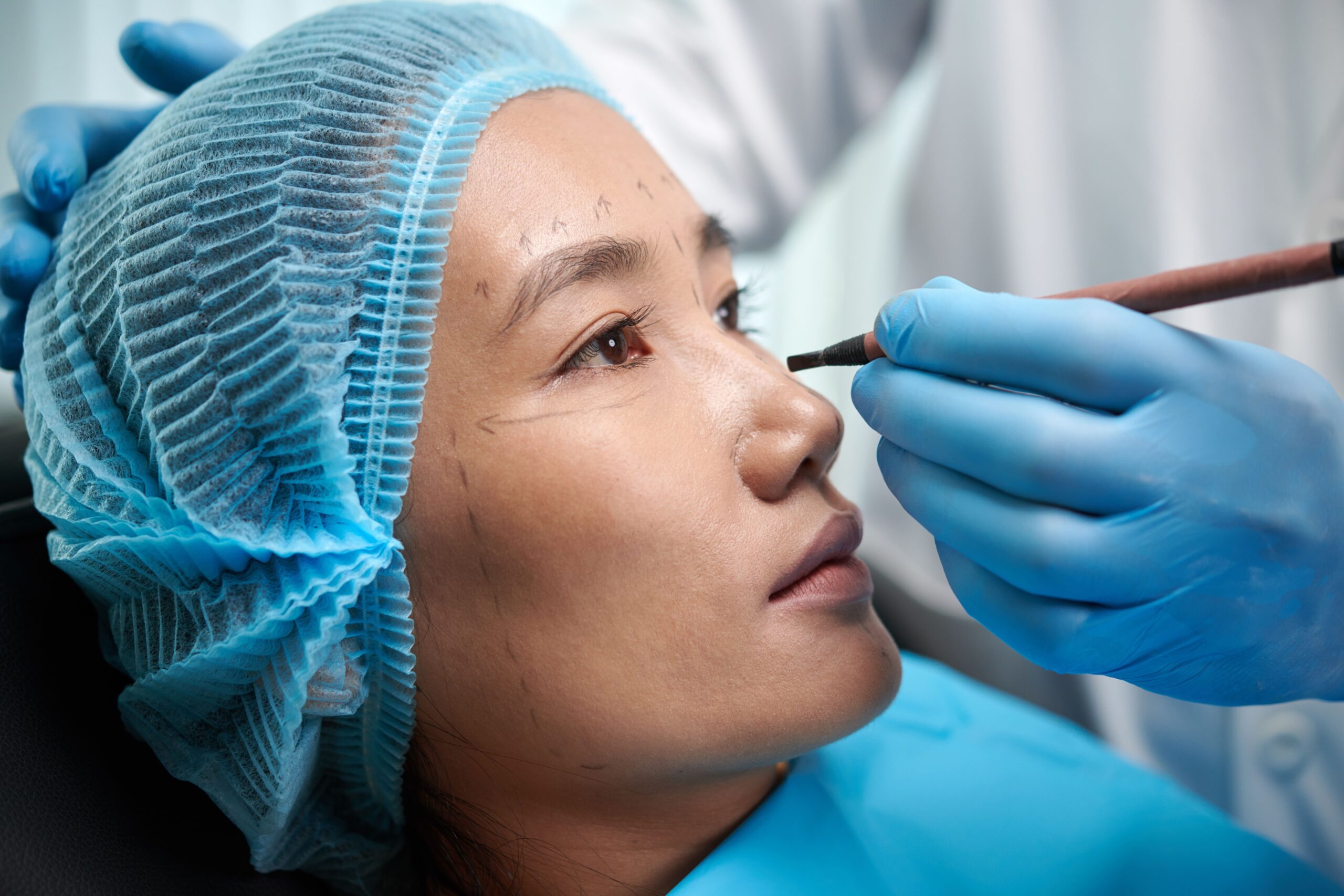 https://www.idsclinic.com/wp-content/uploads/2025/10/surgeon-drawing-lines-on-face-2025-01-29-08-02-52-utc-scaled.jpgDark Eye Circles Treatment in Singapore