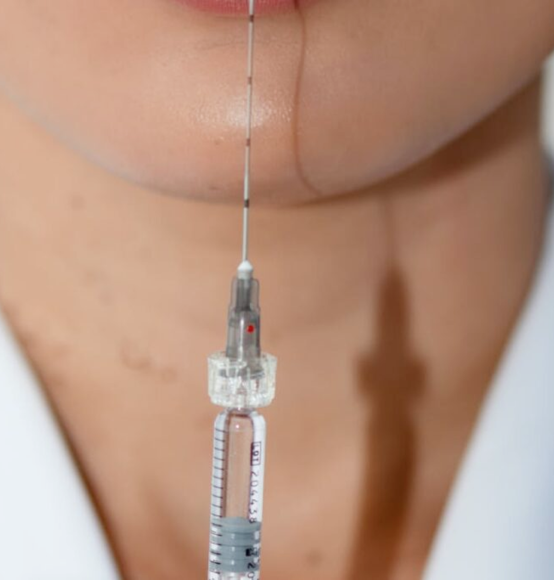 https://www.idsclinic.com/wp-content/uploads/2026/09/Shutterstock_1635655294.pngCollagen Stimulating Injections in Singapore